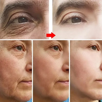 Anti-Wrinkle Firming Cream – Retinol + Vitamin C – Reduces Fine Lines & Wrinkles, Firms & Lifts Skin, Deep Hydration – For Eyes & Face