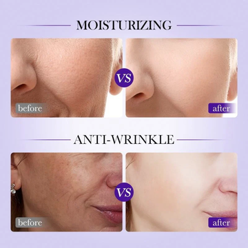 Simbax Anti-Wrinkle Serum – 4x Collagen & Hyaluronic Acid Production – Reduces Wrinkles, Tightens Skin, Improves Elasticity – For Under Eyes, Cheeks, Forehead & Neck
