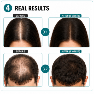 Pilgrim Advanced Hair Growth Serum – Stronger Roots, Thicker Hair, Confident You – Boosts Hair Growth, Reduces Hair Fall, Nourishes Scalp – For Women & Men