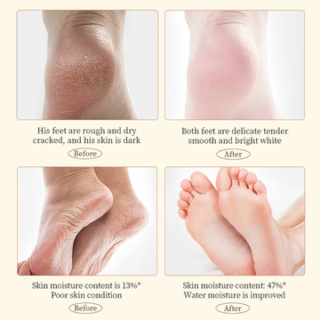 Organi Hub Hand & Foot Cream | 100% Organic Formula for Dark Hands, Feet, Knuckles & Cracked Heels | Deep Moisturizing & Skin Repair
