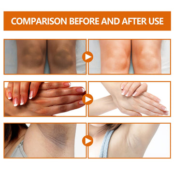 Seebz Intima Glow Serum | Multi-Area Whitening with Vitamin C, Alpha Arbutin & Kojic Acid | Hydrates, Fades Dark Spots & Brightens Hyperpigmentation